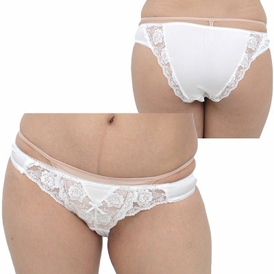 �Q�������X�g���b�`�O�ヌ�[�X�I�[�v���t���o�b�N�@�z���C�g